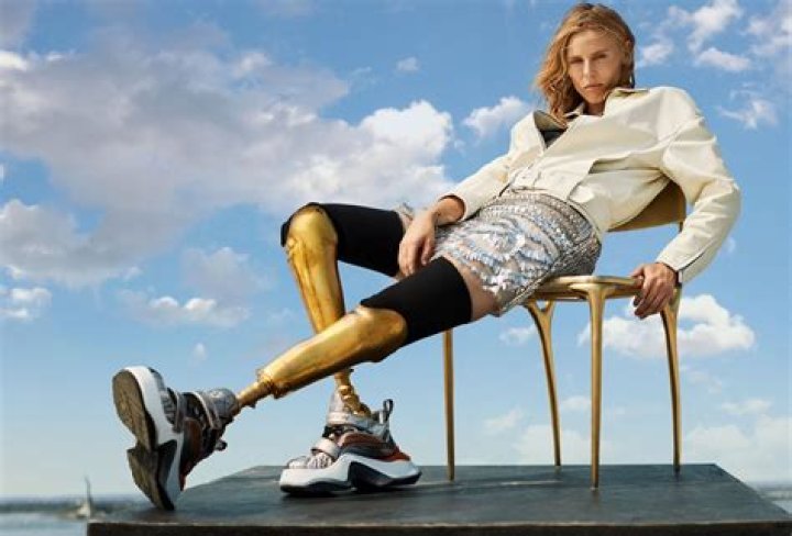 Lauren Wasser (Golden Legs Model) Wiki, Biography, Age, Wife