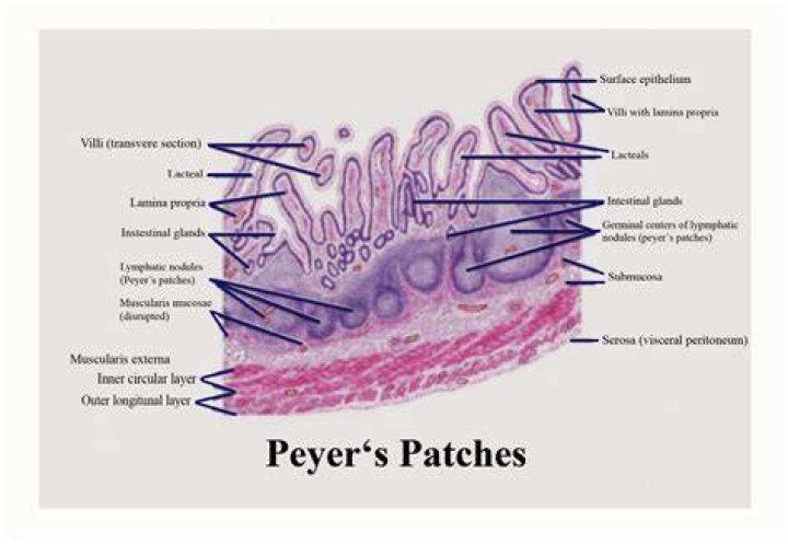 Unveiling The Power Of Peyer's Patches